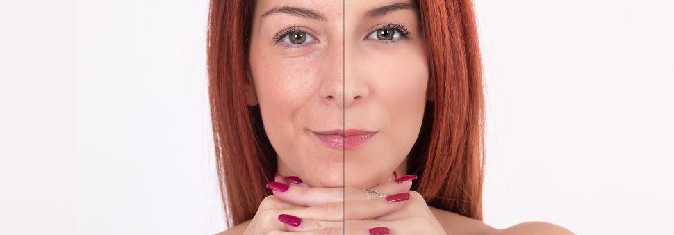 femme peau rajeunit collagene biophenix Image